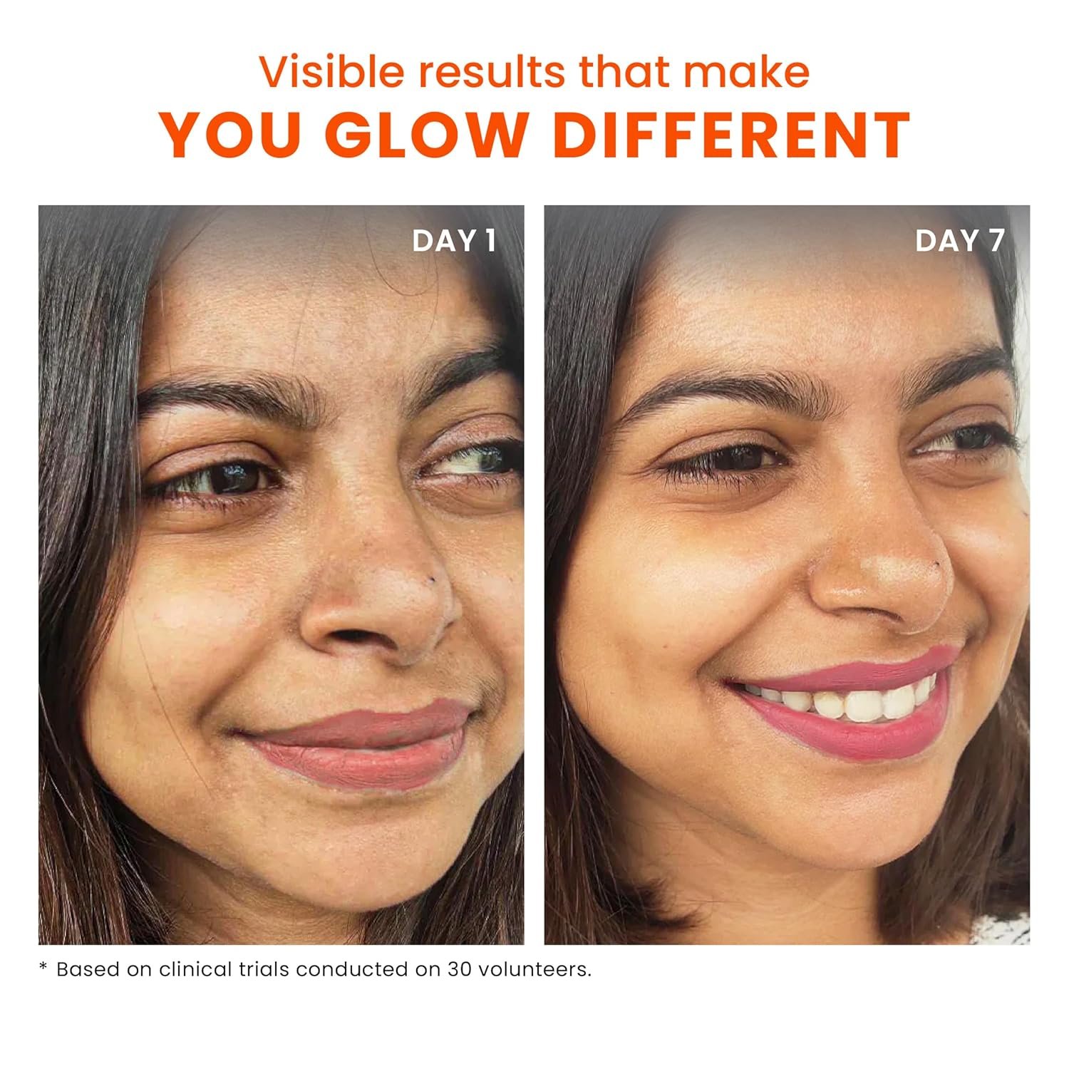 Foxtale Overnight Glow Mask | 4% Glycolic Acid | 3% Lactic Acid |Reduces Blackheads, Whiteheads | 30 Second Salon like Brightening Facial for Glowing Skin | Men & Women - 30ml - Image 2