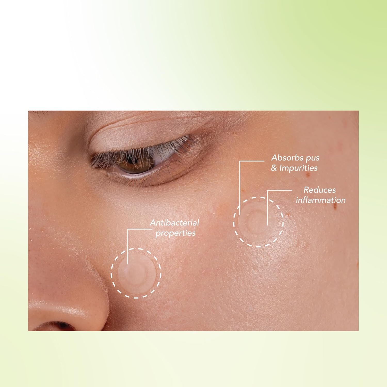 DR.RASHEL Neem Acne Pimple Patch with Salicylic Acid, Hydrocolloid Patches for Zits and Blemishes, 36 Patches - Image 4