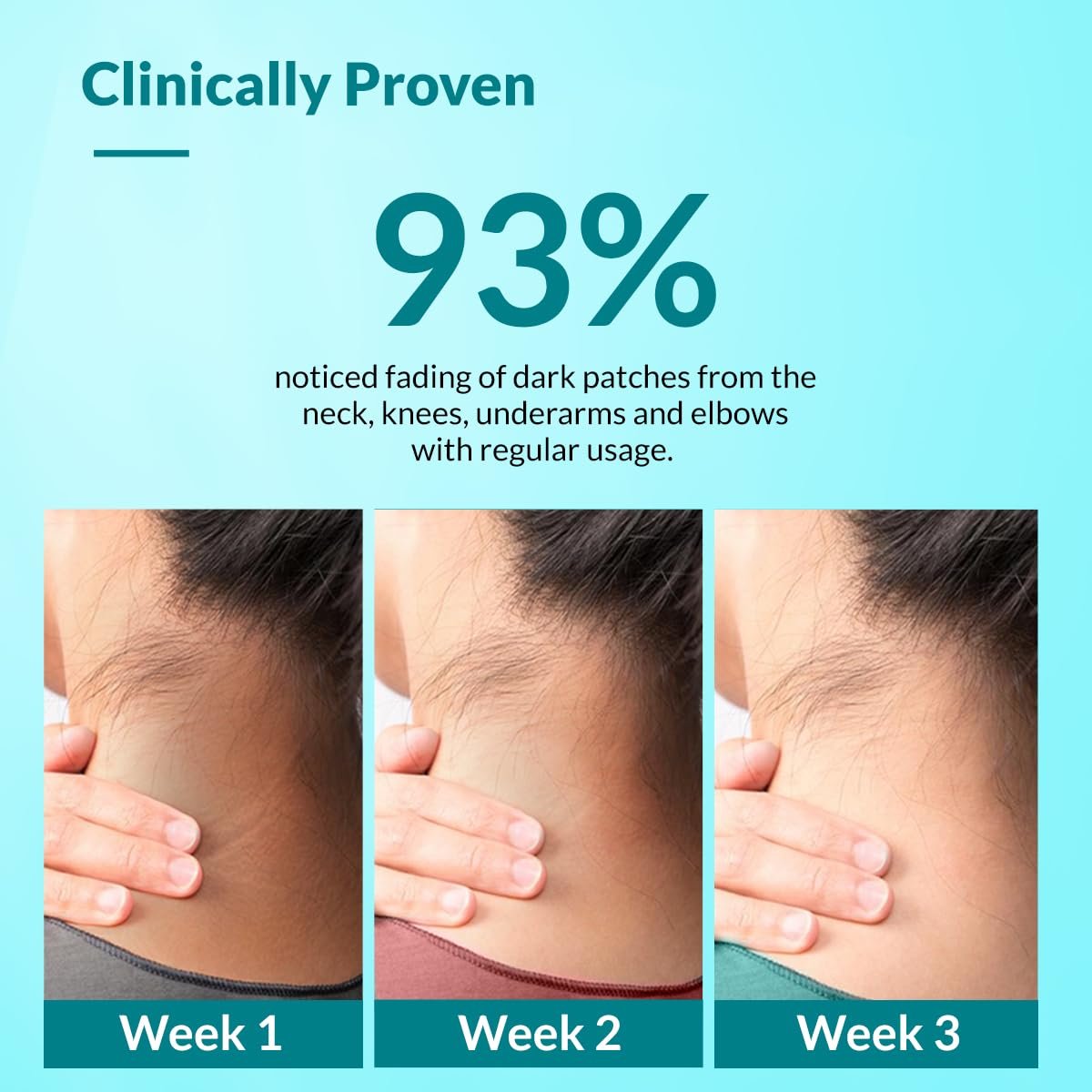 Fixderma Nigrifix Cream for Acanthosis Nigricans with Lactic Acid | Dermatologist Tested Retinol Cream | For Dark Body Parts like Neck, Ankles, Knuckles, Armpits, Thighs & Elbows | Exfoliant - 50g - Image 2